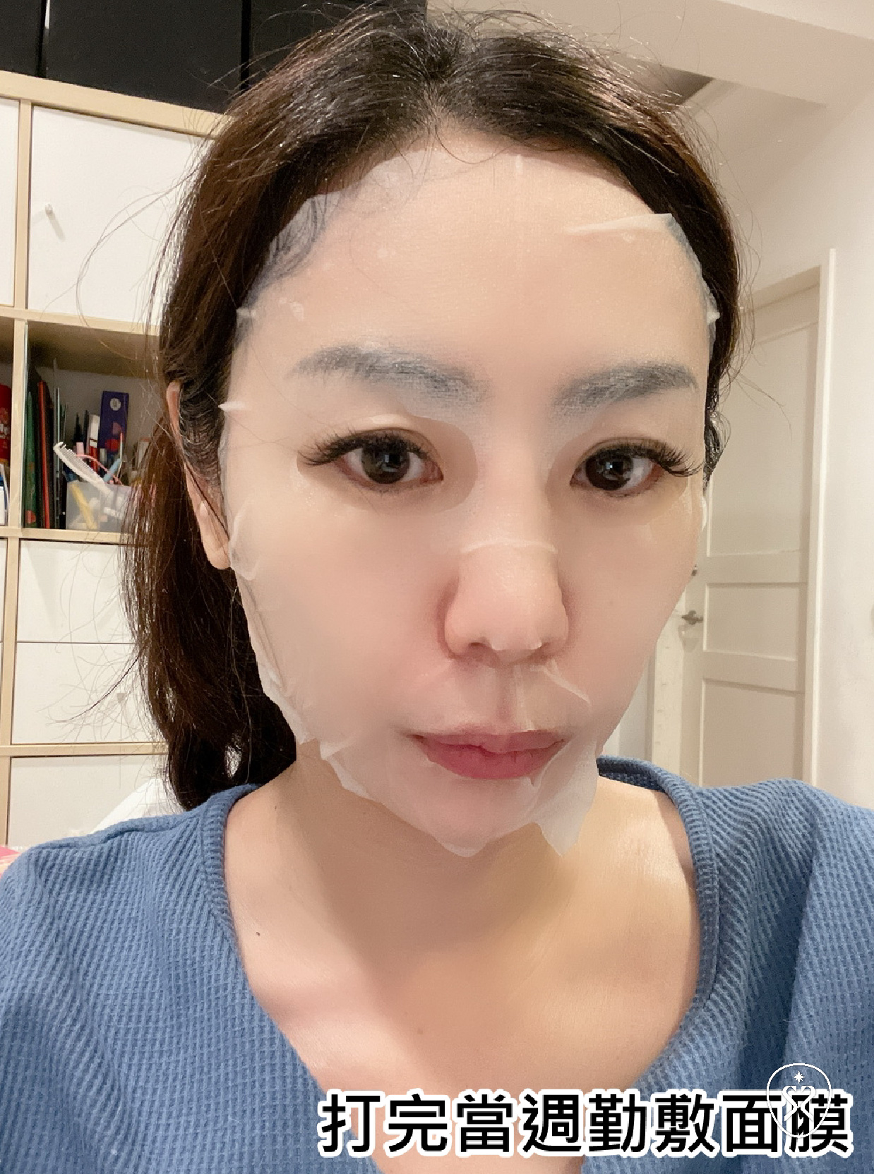 【玻尿酸】星采皮膚專科診所(古亭)-不再焦慮！輕鬆獲得一個順眼的自己 -小雯媽咪愛漂亮